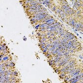 Anti-ALDH1A1 antibody produced in rabbit