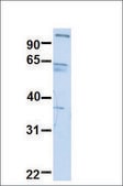 Anti-SUV420H1 antibody produced in rabbit affinity isolated antibody
