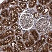 Anti-ATP6V1H antibody produced in rabbit Prestige Antibodies® Powered by Atlas Antibodies, affinity isolated antibody, buffered aqueous glycerol solution