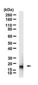 Anti-Claudin-5 Antibody, clone 3H12 ZooMAb® Rabbit Monoclonal recombinant, expressed in HEK 293 cells