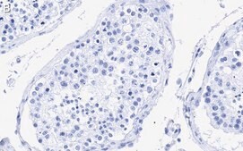 Anti-Centrin Antibody, clone 20H5 ZooMAb® Mouse Monoclonal recombinant, expressed in HEK 293 cells