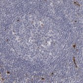 Anti-SLC9A3R2 antibody produced in rabbit Prestige Antibodies® Powered by Atlas Antibodies, affinity isolated antibody, buffered aqueous glycerol solution