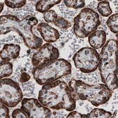 Monoclonal Anti-TUFM antibody produced in mouse Prestige Antibodies® Powered by Atlas Antibodies, clone CL2245, purified immunoglobulin, buffered aqueous glycerol solution