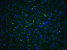 OSUMMER.10 Mouse NRAS-Mutant Melanoma Cell Line