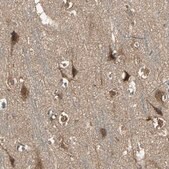 Anti-KANK1 antibody produced in rabbit Prestige Antibodies® Powered by Atlas Antibodies, affinity isolated antibody, buffered aqueous glycerol solution