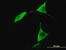 Monoclonal Anti-ALDH1L1 antibody produced in mouse clone 3E9, purified immunoglobulin, buffered aqueous solution