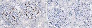 Anti-Wilms Tumor Protein Antibody, clone 2O18 ZooMAb® Rabbit Monoclonal recombinant, expressed in HEK 293 cells