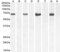 Anti-NOX1 antibody produced in goat affinity isolated antibody, buffered aqueous solution