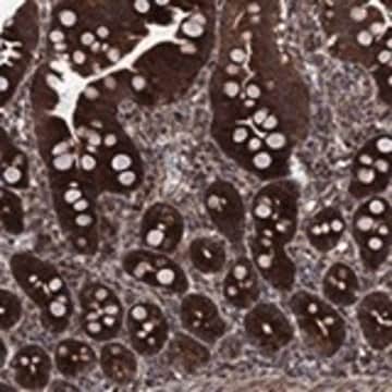 Anti-HDAC4 antibody produced in rabbit Prestige Antibodies® Powered by Atlas Antibodies, affinity isolated antibody, buffered aqueous glycerol solution