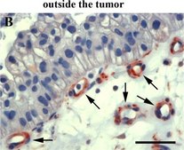 Anti-Mouse IgG (whole molecule)–Peroxidase antibody produced in goat affinity isolated antibody, buffered aqueous solution