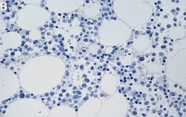 Anti-Bcl-xL Antibody, clone 1O8 ZooMAb® Rabbit Monoclonal recombinant, expressed in HEK 293 cells