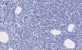 Anti-phospho-IRS1 (Tyr612) Antibody, clone 1N14, ZooMAb® Rabbit Monoclonal recombinant, expressed in HEK 293 cells