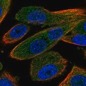 抗-RNF31 兔抗 Prestige Antibodies® Powered by Atlas Antibodies, affinity isolated antibody, buffered aqueous glycerol solution