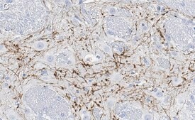 Anti-Calretinin Antibody, clone 6B8.2 ZooMAb® Mouse Monoclonal recombinant, expressed in HEK 293 cells