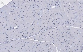 Anti-Dystrophin Antibody, clone 2C6 (MANDYS106) ZooMAb® Mouse Monoclonal recombinant, expressed in HEK 293 cells