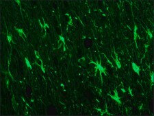 抗- 胶质纤维酸性蛋白抗体，小鼠单克隆 clone G-A-5, purified from hybridoma cell culture