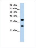 Anti-PCBP2 (AB1) antibody produced in rabbit IgG fraction of antiserum