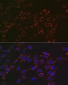Anti-ACAA2 Antibody, clone 8H6H5, Rabbit Monoclonal