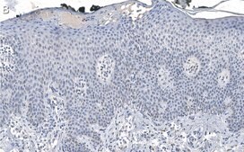 Anti-DNA-RNA hybrid Antibody, clone S9.6 ZooMAb® Mouse Monoclonal recombinant, expressed in HEK 293 cells