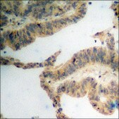 Anti-phospho-SGK (pSer78) antibody produced in rabbit affinity isolated antibody