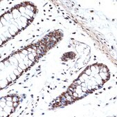 Anti-HMGB2 antibody produced in rabbit