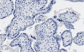 Anti-Ago 1 Antibody, clone 1L3 ZooMAb® Rabbit Monoclonal recombinant, expressed in HEK 293 cells