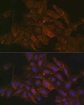 Anti-KRAS+HRAS+NRAS Antibody, clone 6S6F3, Rabbit Monoclonal