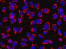 Monoclonal Anti-Collagen, Type X antibody produced in mouse clone COL-10, ascites fluid