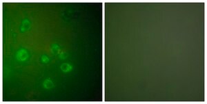 抗-GRP78 兔抗 affinity isolated antibody