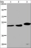 Anti-TDP2 antibody produced in rabbit affinity isolated antibody