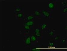 Monoclonal Anti-CDK5RAP3 antibody produced in mouse clone 1G4, purified immunoglobulin, buffered aqueous solution