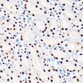 Anti-PBRM1 antibody produced in rabbit