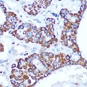 Anti- CASP1 antibody produced in rabbit