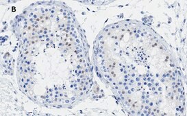 Anti-Androgen Receptor Antibody, clone 3K11 , ZooMAb® Rabbit Monoclonal recombinant, expressed in HEK 293 cells