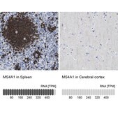 Anti-MS4A1 antibody produced in rabbit Prestige Antibodies® Powered by Atlas Antibodies, affinity isolated antibody, buffered aqueous glycerol solution
