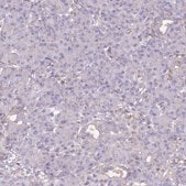 Anti-ADH1A antibody produced in rabbit Prestige Antibodies® Powered by Atlas Antibodies, affinity isolated antibody, buffered aqueous glycerol solution