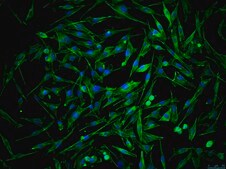 OSUMMER.2 Mouse NRAS-Mutant Melanoma Cell Line