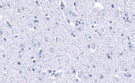 Anti-Histone H2B Antibody, clone 4O11 ZooMAb® Rabbit Monoclonal recombinant, expressed in HEK 293 cells
