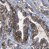 抗-CLDN18 兔抗 Prestige Antibodies® Powered by Atlas Antibodies, affinity isolated antibody, buffered aqueous glycerol solution