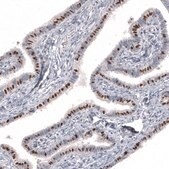 Monoclonal Anti-FOXJ1 antibody produced in mouse Prestige Antibodies® Powered by Atlas Antibodies, clone CL3991, purified immunoglobulin