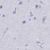 Anti-SERPINA3 antibody produced in rabbit Prestige Antibodies® Powered by Atlas Antibodies, affinity isolated antibody, buffered aqueous glycerol solution