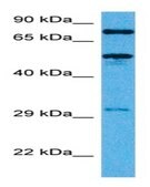 Anti-TFE3 antibody produced in rabbit affinity isolated antibody