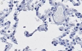 Anti-ACE2-cytoplasmic Antibody, clone 1C17 ZooMAb® Rabbit Monoclonal recombinant, expressed in HEK 293 cells