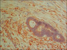 Anti-PKM2 (isoform M2) antibody produced in rabbit ~1.5 mg/mL, affinity isolated antibody