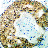 Anti-phospho-GSK3 α (pSer21) antibody produced in rabbit affinity isolated antibody