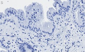 抗-Nrf2 抗体，克隆5B20 ，ZooMAb®兔单克隆抗体 recombinant, expressed in HEK 293 cells