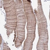 Anti-TACC2 antibody produced in rabbit Prestige Antibodies® Powered by Atlas Antibodies, affinity isolated antibody, buffered aqueous glycerol solution