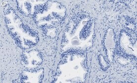 Anti-PRMT5 Antibody, clone 1H16 ZooMAb® Rabbit Monoclonal recombinant, expressed in HEK 293 cells