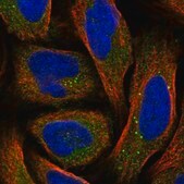 Anti-SRD5A3 antibody produced in rabbit Prestige Antibodies® Powered by Atlas Antibodies, affinity isolated antibody, buffered aqueous glycerol solution