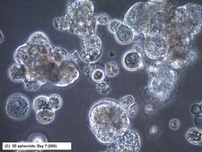 CR4 Human Colorectal Cancer Cell Line CR4 is a unique, cancer stem cell (CSC) enriched, human colorectal cancer cell line useful for CSC-targeted drug development and research focused on cancer cell and CSC biology.
